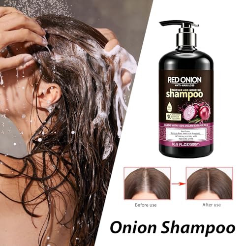 Onion Shampoo for Hair Growth & Anti-Hair Loss - 500ML