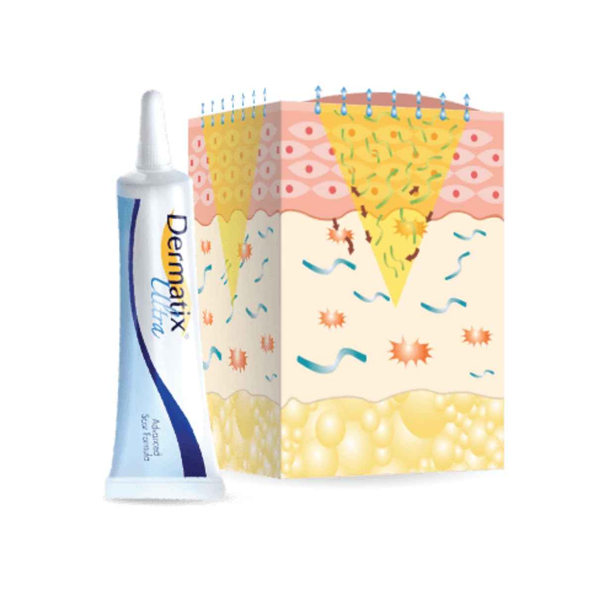 Dermatix Ultra Advanced Scar Gel - 15g, Softens and Flattens Scars, Quick-Drying and Odorless Formula