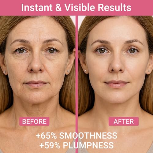 Vevivia PDRN Pink Collagen Multi Balm Stick - Plumping & Firming