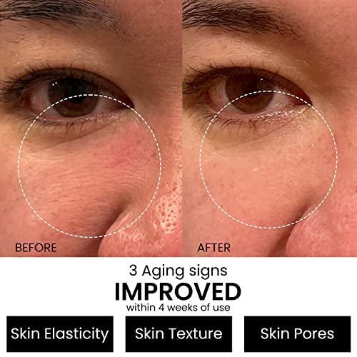 Retinol Serum 2.5% for Face Anti Aging Serum with Hyaluronic Acid to Minimize Wrinkles. Improves Sun Damaged Skin and Fades Dark Spots - Vitamin A Serum - Dermatologist Tested & MADE in USA