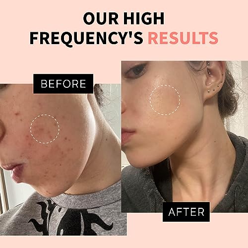 OxyGlow 2 Cordless High Frequency Facial Wand with 3 Tubes