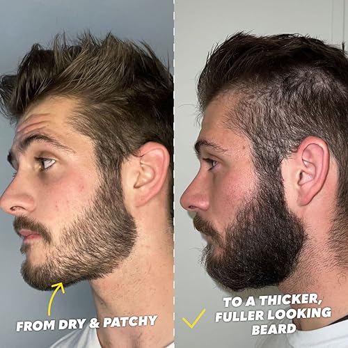 The Beard Club Signature Beard Growth Kit - Derma Roller, Beard Growth Oil, Beard Growth Vitamins, Vitamin Spray & Beard Brush - Gift Set