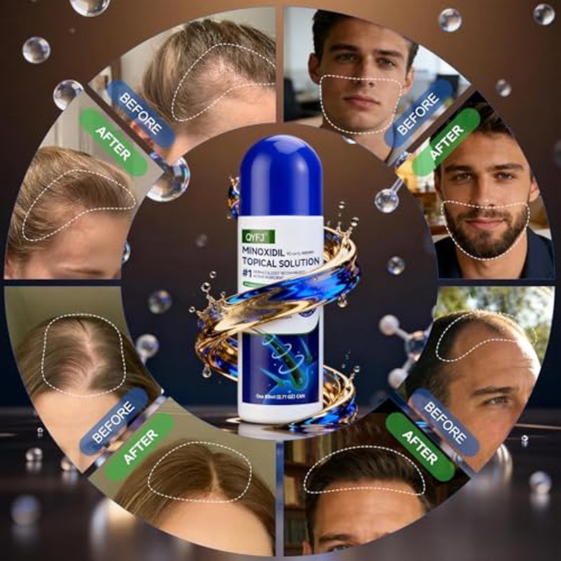 5% Minoxidil Hair Growth Serum for Men & Women - 4-Month Supply