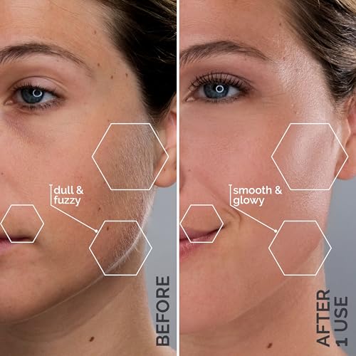 SIMA Electric Dermaplaning Tool for Women | Facial Hair Removal & Exfoliation