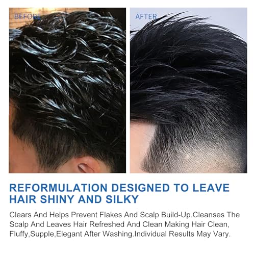 Ceson&Cesun Anti-Fungal 2-in-1 Shampoo for Scalp Relief