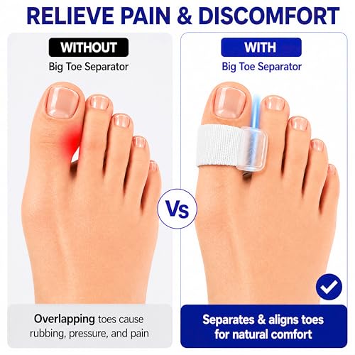 Big Toe Spacers for Bunion Pain Relief & Hallux Valgus Correction
