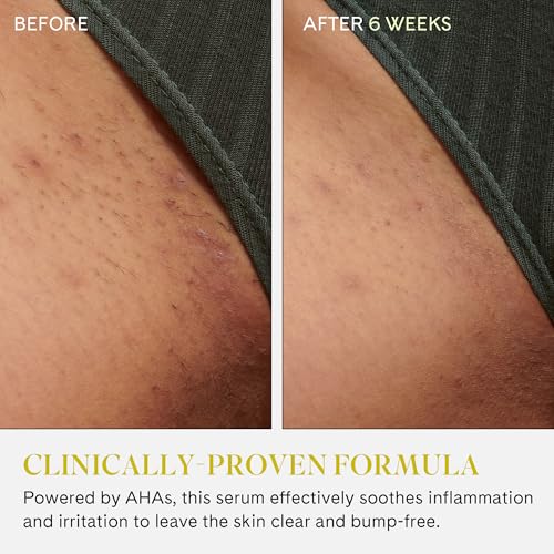 Fur Ingrown Eliminator Serum Rollerball - Powerful Ingrown Hair Treatment Serum With AHAs and BHAs to Treat and Prevent Ingrown Hairs and Bumps, Hydrates and Soothes Irritated Skin - 50 ml