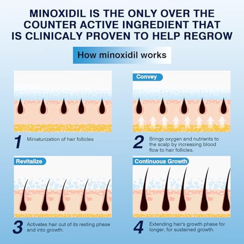 5% Minoxidil Foam Hair Regrowth Treatment for Men & Women