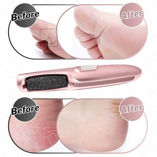 Care me Rose Gold Electric Callus Remover Wand - Rechargeable Foot File & Pedicure Tool