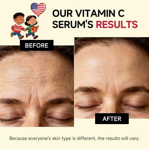 Vitamin C Face Serum & Essence by HONLINK, 5X Vitamin C with Niacinamide & Hyaluronic Acid, Lightweight Hydrating Serum for Dull Skin, Uneven Tone & Pores, Valentine¡¯s Day Skincare Gift for Her