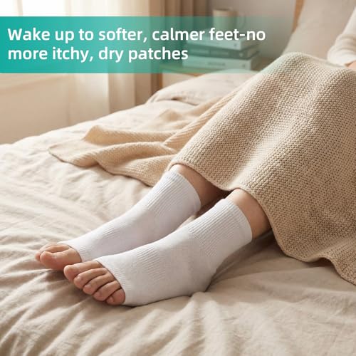 Shyyween Cotton Open-Toe Eczema Socks for Moisturizing Foot Therapy, 4-Pack
