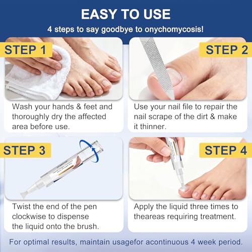 Drawzone Extra Strength Toenail Fungal Treatment Pen 4 Pack - 25% Undecylenic Acid, Ingrown Nail Care