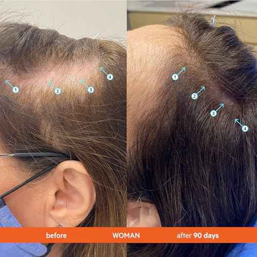 DS Labs Revita Conditioner Refill Pouch, 500 mL ? Scalp Refreshing Hydration for Fuller Looking, Weightless Hydration, Caffeine, Turmeric, Sulfate & Silicone Free, Color Safe, For Men & Women