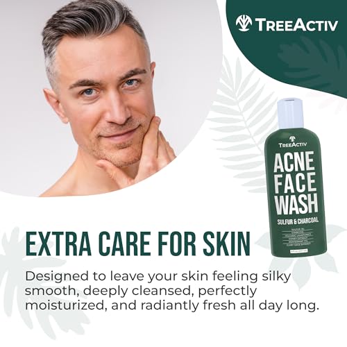 TreeActiv Charcoal Acne Exfoliating Face Wash | Hydrating Sulfur Cleanser for Pimple, Zit, Whitehead, & Blackhead | Facial Treatment for Hormonal & Cystic Acne | Teen & Adult Milia Remover | 425+ Uses