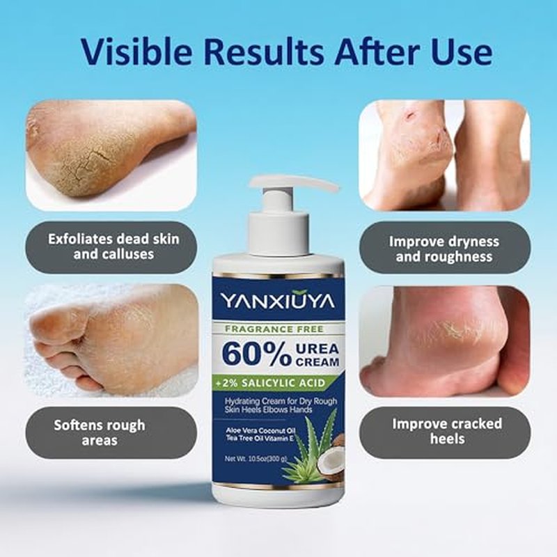 60% Urea Cream for Cracked Heels & Dry Feet, 10.5 oz