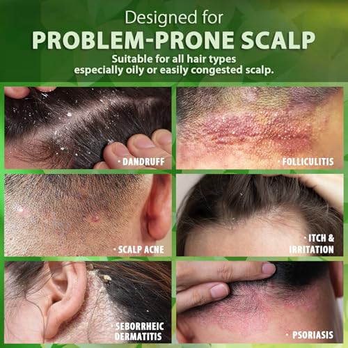 Recuren Plus Folliculitis & Scalp Treatment Shampoo - Anti-Fungal, Soothing, Sulfate-Free