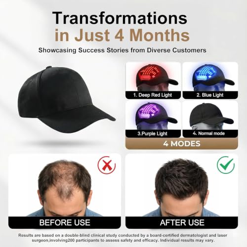 AUQLEF Red Light Therapy Hair Growth Cap - 650nm LLLT for Thinning Hair