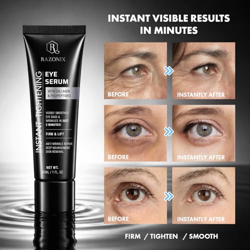 RazoniX Instant Eye Lift Serum for Dark Circles & Puffiness, 2-Minute Tightening, Hyaluronic & Caffeine