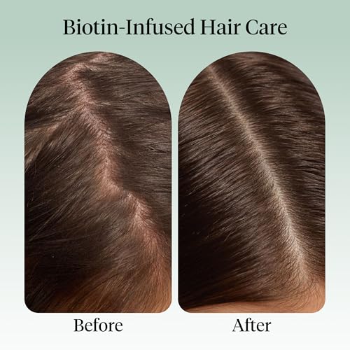 Kitsch Rosemary Hair & Scalp Oil with Biotin - Pre-Wash Hair Treatment, 10ml