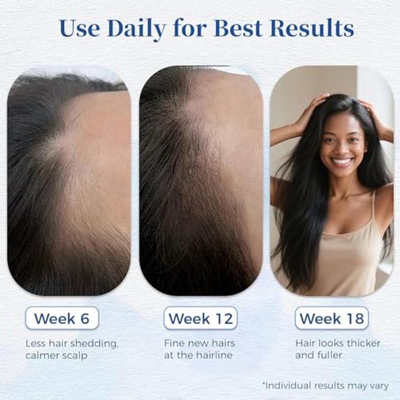 Hair Growth Serum for Thinning Hair - Biotin Roll-On, 30ml