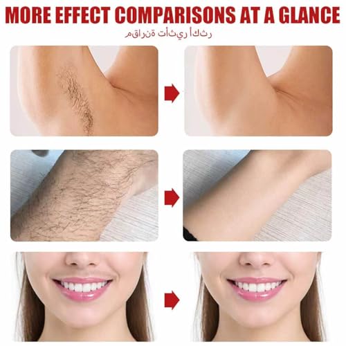 xiaoks 1Pack Gentle Coconut Hair Removal Cream for Women, Sensitive Skin