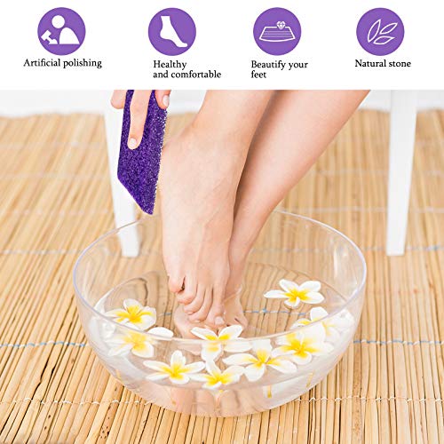 40 Pcs Pumice Stones for Feet - Callus Remover and Foot Scrubber