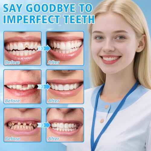 Tooth Repair Kit, Moldable False Teeth Beads, for Missing, Broken Temporary Thermoplastic Beads, Comfortable DIY at Home Use