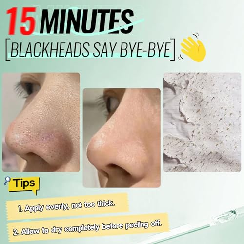 SYABO 2.0 Blackhead Remover Mask with Salicylic Acid | 100 Strips