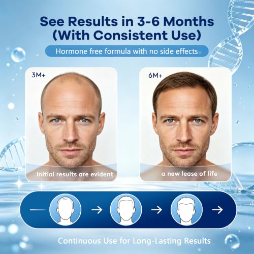 Men's 5% Minoxidil Foam with Biotin - Hair & Beard Growth