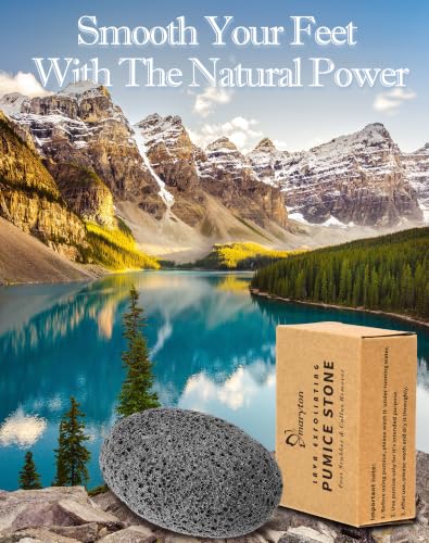 Maryton 2pcs Natural Lava Pumice Stones for Feet & Hands Callus Removal