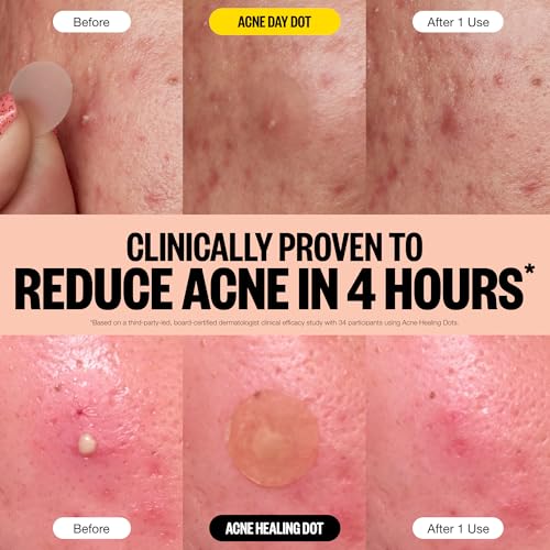 PEACE OUT Acne Day & Night Duo, Invisible Acne Patches for Day + Healing Overnight Acne Treatment, Clear Blemishes Fast with 2% Salicylic Acid, Retinol & Aloe Vera, 20 Dots