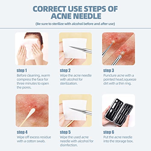 JPNK Silver Blackhead Remover Kit - Comedone Extractor for Acne & Blemishes