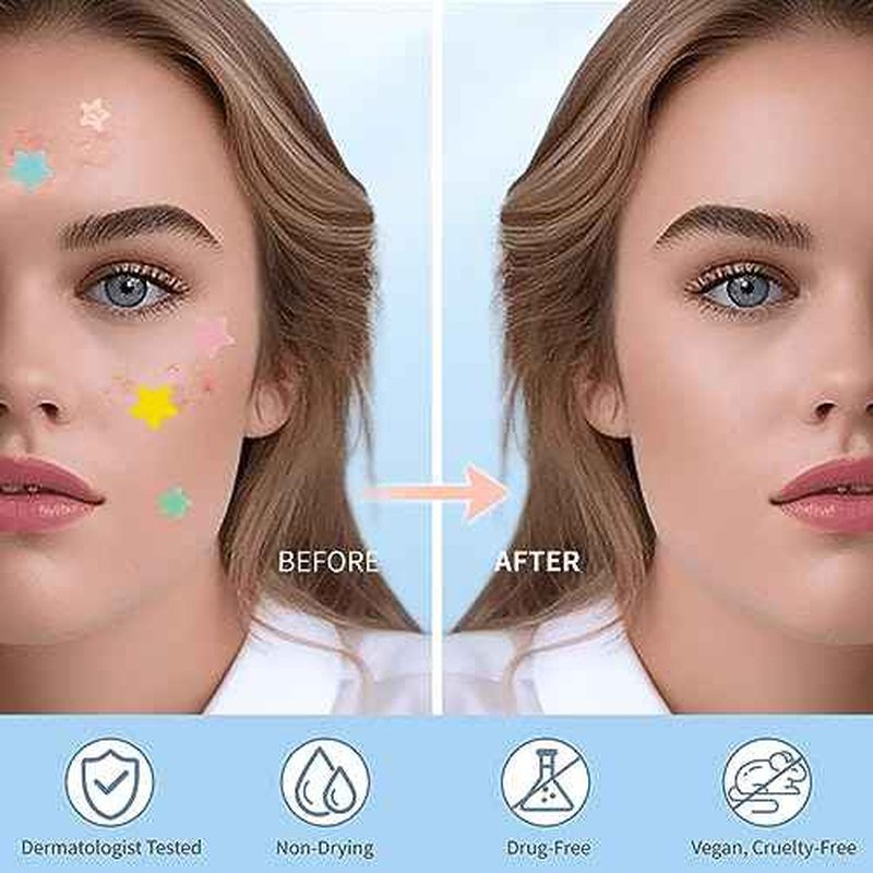 Pimple Patches for Face, Colorful Hydrocolloid Acne Patches, Cute Star Zit Covers for Face, Spot Stickers with Tea Tree, Salicylic Acid & Cica Oil| 4 Sizes (8mm, 10mm, 12mm & 14mm) |357 Count