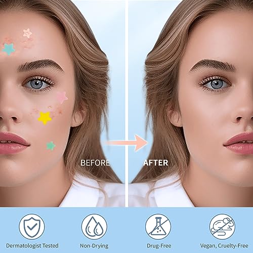 Pimple Patches for Face, Hydrocolloid Acne Patches, Cute Star Zit Covers, Colorful Spot Stickers with Tea Tree, Salicylic Acid & Cica Oil| 3 Sizes (10mm, 12mm & 14mm) |200 Count