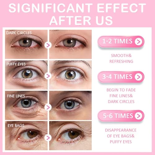 30 Pairs Lip Mask & Eye Mask, Under Eye Patches, Anti Wrinkle Patches for Lip, Reducing Dark Circles, Small Gifts for Women, Bridesmaid Gifts, Hangover Kit, Bulk Gifts, Bachelorette Party Favors