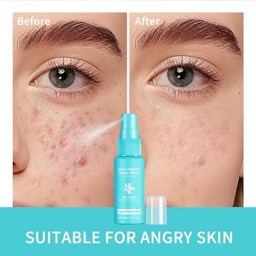 Daily Rescue Facial Spray, Hypochlorous Acid Spray, Reduce Redness and Breakouts, 100% Natural Fragrance Free, Alcohol Free, Oil Free, Cruelty Free Vegan (2)