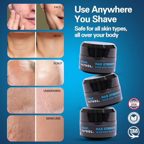 Bump Patrol Max Strength Razor Bump Treatment Cream - Concentrated Cream Formula Aftershave Solution for Razor Bumps, Prevents Ingrown Hairs & Irritation Everywhere You Shave - 0.5 oz (Pack of 1)