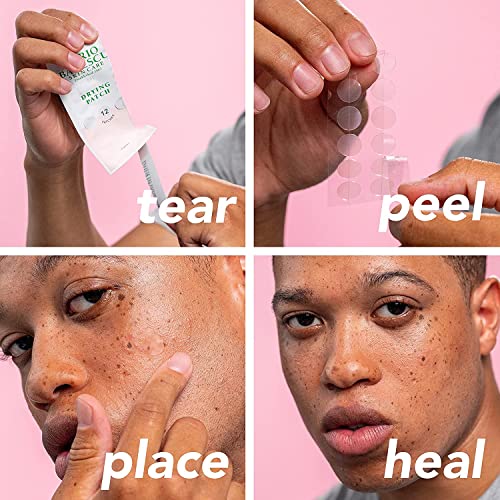 Mario Badescu Drying Lotion Spot Treatment, 1 fl oz