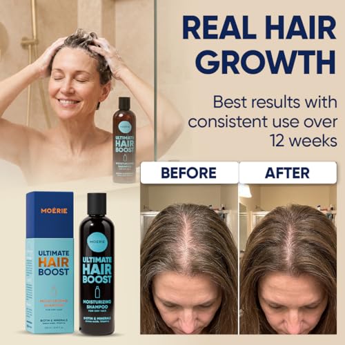 Moerie Hair Growth Shampoo for Men & Women – Biotin & Rosemary, 3-Pack