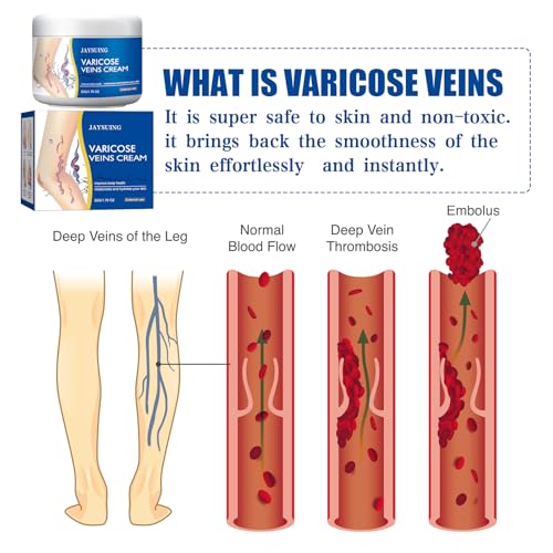 Varicose Veins Relief Cream for Legs ? Soothing, Moisturizing & Circulation Support for Spider Veins & Healthy-Looking Skin ? 2 x 1.76 Oz Tubes