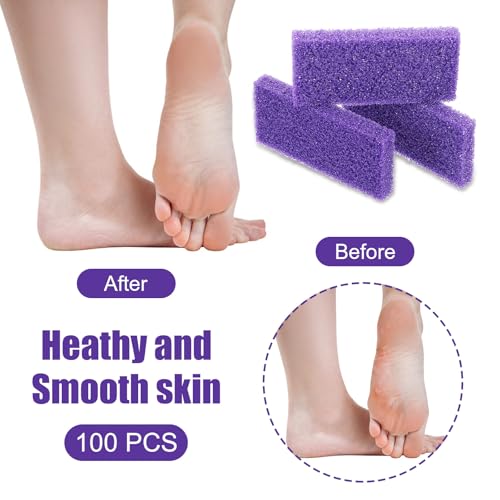 100pcs Exfoliating Pumice Stones for Callus Removal - Double-Sided Foot Scrubbers