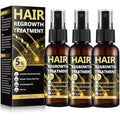 5% Minoxidil Hair Regrowth Spray for Men & Women