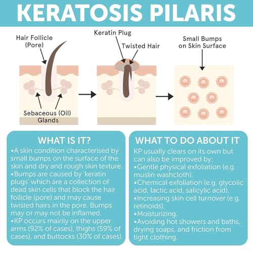 KP Bump Eraser Body Set with 10% AHA - Keratosis Pilaris Treatment