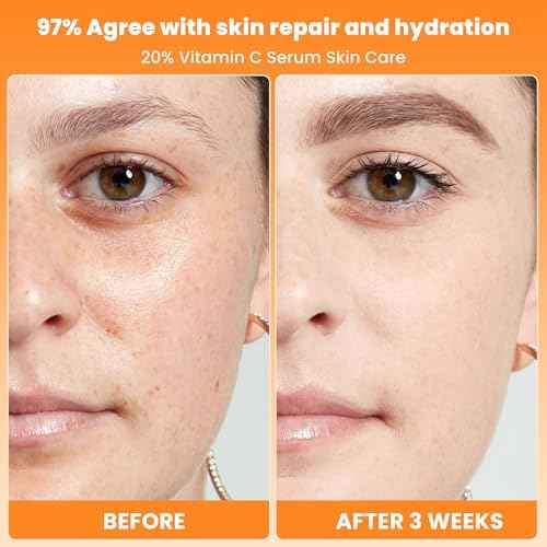 20% Vitamin C Face Serum with Golden Combination of Hyaluronic Acid and Vitamin E | Reduce Acne Spots | Even Skin Tone | Hydrating Face Serum Moisturising & Firming Skin Care | 1 Fl. Oz