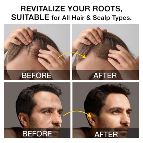 Beadlamey Root Activator Shampoo for Men - Hair Growth & Thinning Hair - 10.1 fl oz (Pack of 1)
