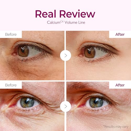 Dr.Melaxin Calcium Hydrogel Eye Patches for Puffy Eyes & Dark Circles (60 Count)