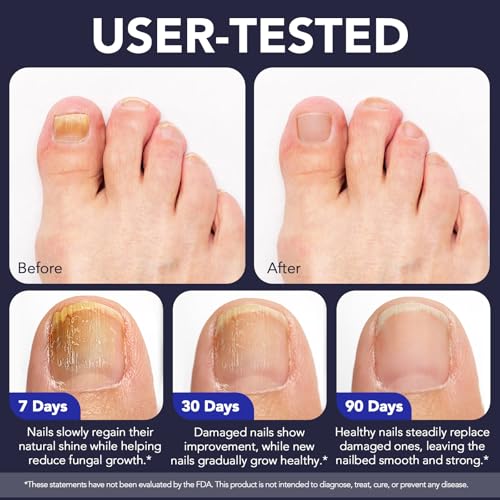 Extra Strength Toenail Fungus Treatment Pen with Tea Tree Oil - 5PCS