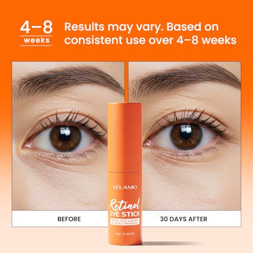 VELAMO ADVANCED Retinol Eye Stick: Plumping & Smoothing Under Eye Balm for Dark Circles, Puffiness & Wrinkles - Made in Korea, Upgraded Formula with Collagen, Niacinamide & Peptides 0.35 OZ/10g 3 Pcs