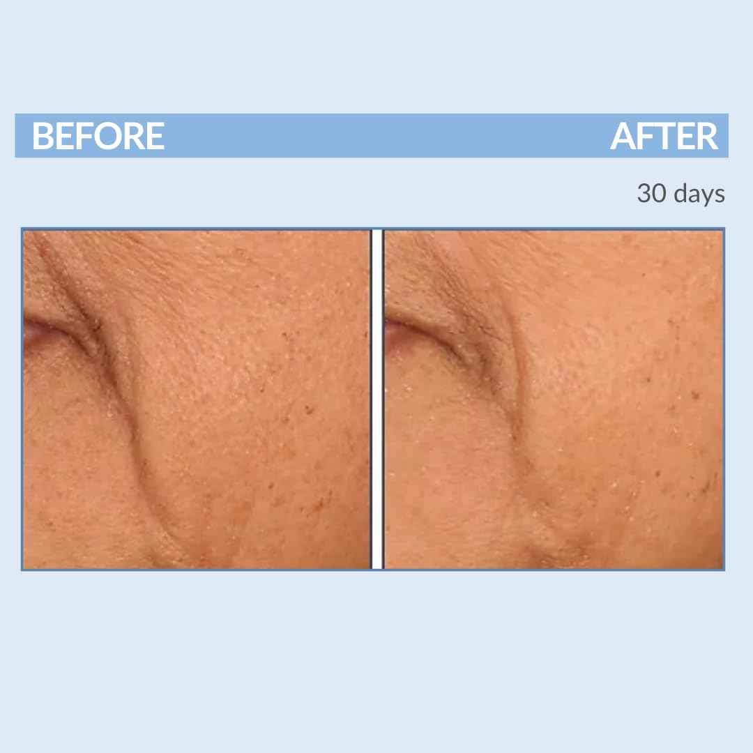 Retinol Vitamin A Resurfacing Pads for Daily Facial Treatment - Niacinamide & Witch Hazel - Exfoliates Skin & Pores - Reduces Fine Lines and Wrinkles - Serious Skincare - 60 Pre-Moistened Disc