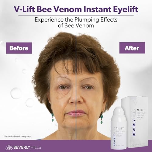 Beverly Hills V-Lift Bee Venom Eye Serum - Reduce Puffy Eyes & Dark Circles